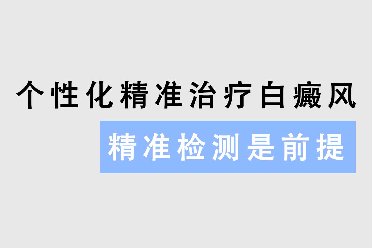 手上白癜风应该怎么办